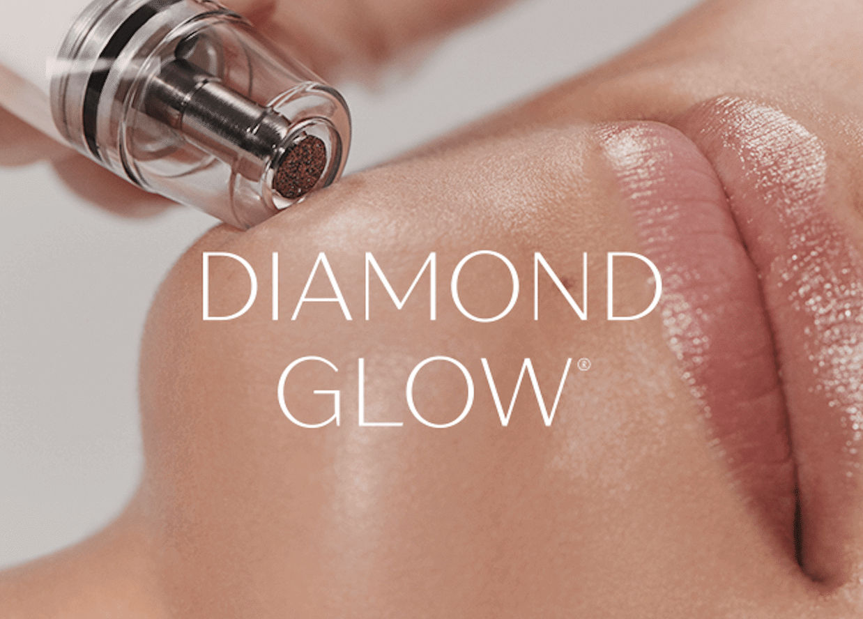 Diamond Glow Ad