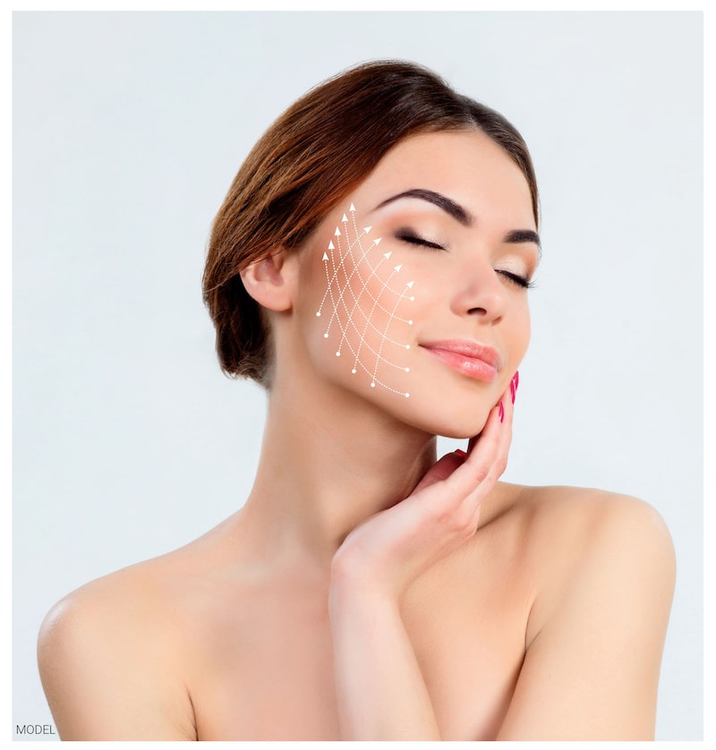Woman with youthful skin and an overlay of a thread lift concept